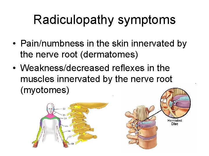 Radiculopathy symptoms • Pain/numbness in the skin innervated by the nerve root (dermatomes) •