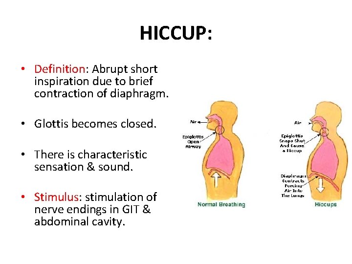 HICCUP: • Definition: Abrupt short inspiration due to brief contraction of diaphragm. • Glottis