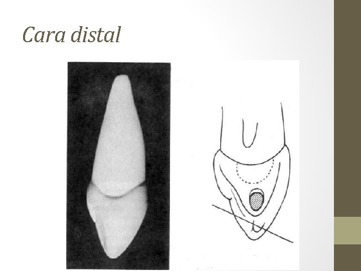 Cara distal 