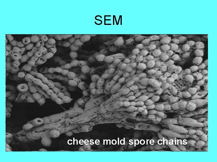 SEM cheese mold spore chains 
