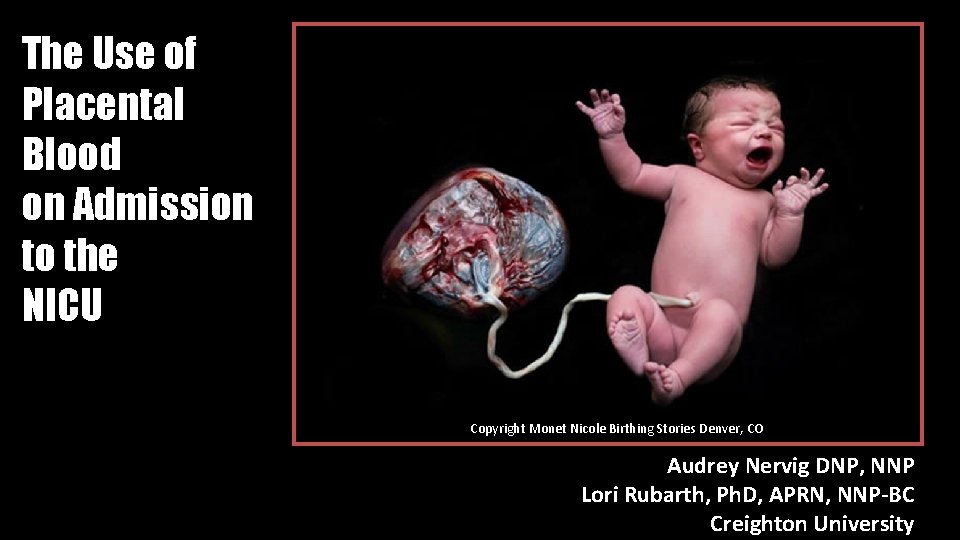 The Use of Placental Blood on Admission to the NICU Copyright Monet Nicole Birthing