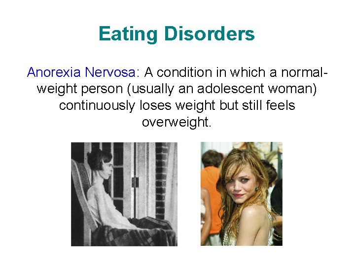 Eating Disorders Anorexia Nervosa: A condition in which a normalweight person (usually an adolescent