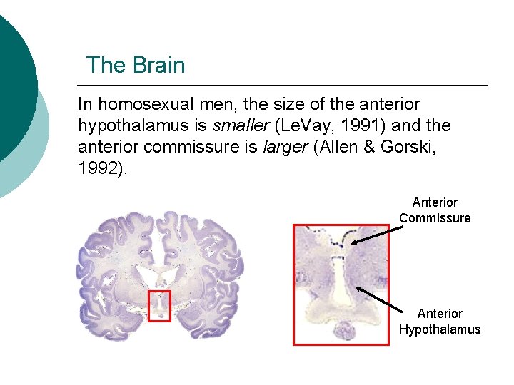 The Brain In homosexual men, the size of the anterior hypothalamus is smaller (Le.