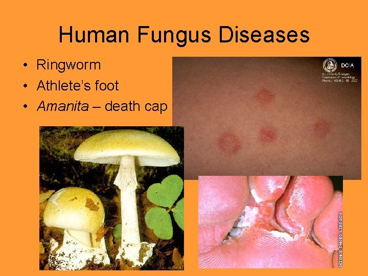 Human Fungus Diseases • Ringworm • Athlete’s foot • Amanita – death cap 