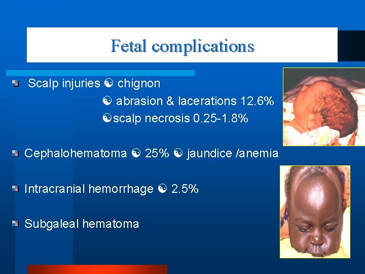 Fetal complications Scalp injuries chignon abrasion & lacerations 12. 6% scalp necrosis 0. 25