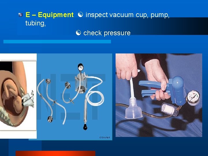 E – Equipment inspect vacuum cup, pump, tubing, check pressure 