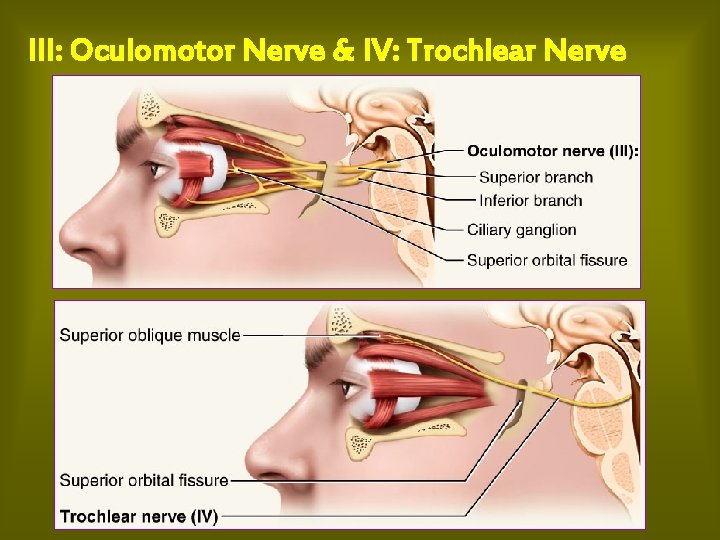 III: Oculomotor Nerve & IV: Trochlear Nerve 