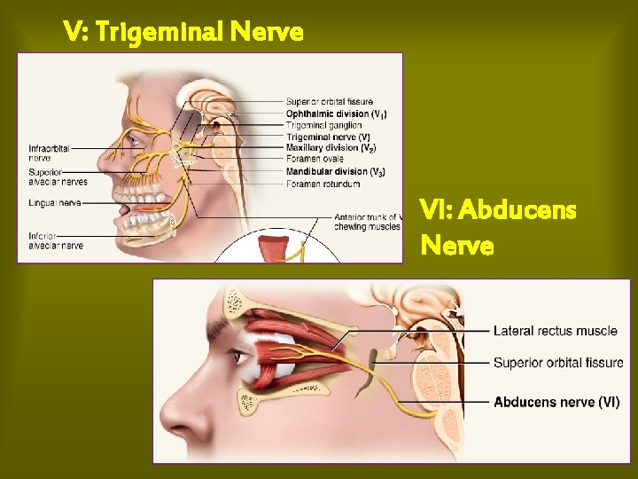 V: Trigeminal Nerve VI: Abducens Nerve 