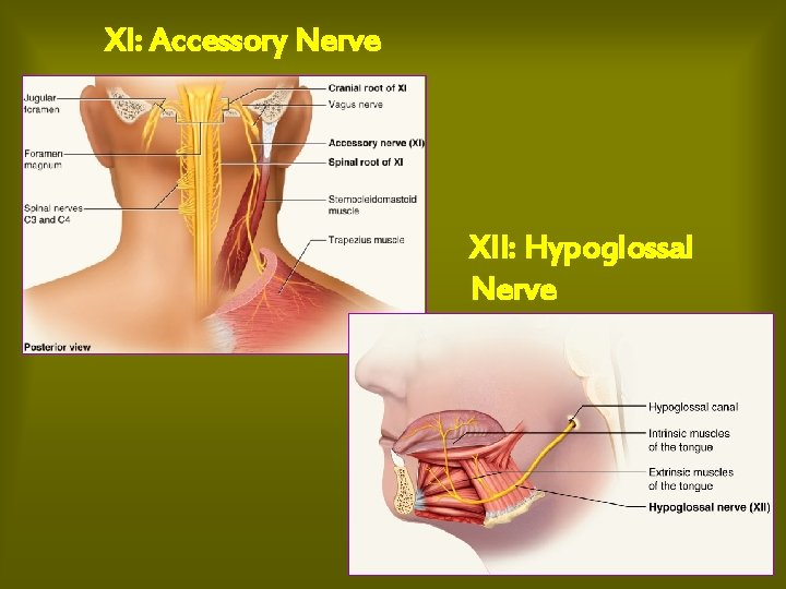XI: Accessory Nerve XII: Hypoglossal Nerve 