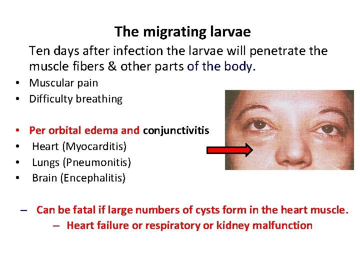The migrating larvae Ten days after infection the larvae will penetrate the muscle fibers