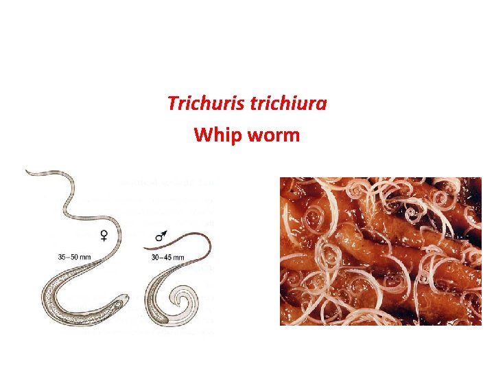 Trichuris trichiura Whip worm 