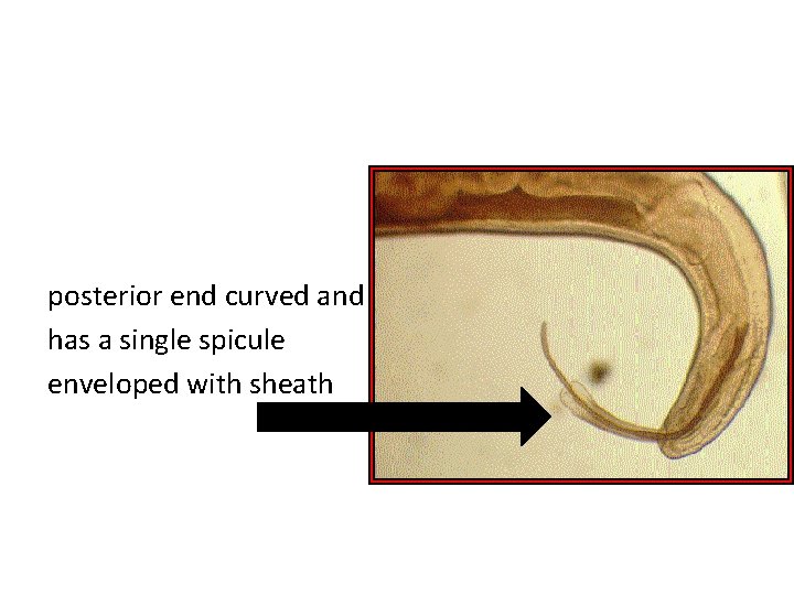 posterior end curved and has a single spicule enveloped with sheath 