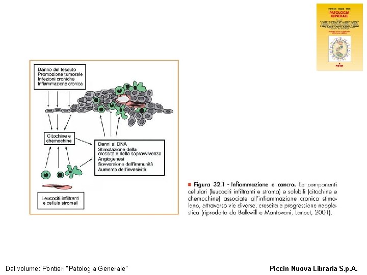 Figura 32. 1 - Infiammazione e cancro. Dal volume: Pontieri “Patologia Generale” Piccin Nuova