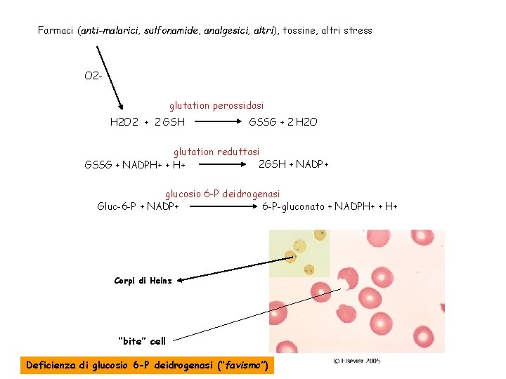 Farmaci (anti-malarici, sulfonamide, analgesici, altri), tossine, altri stress O 2 glutation perossidasi H 2