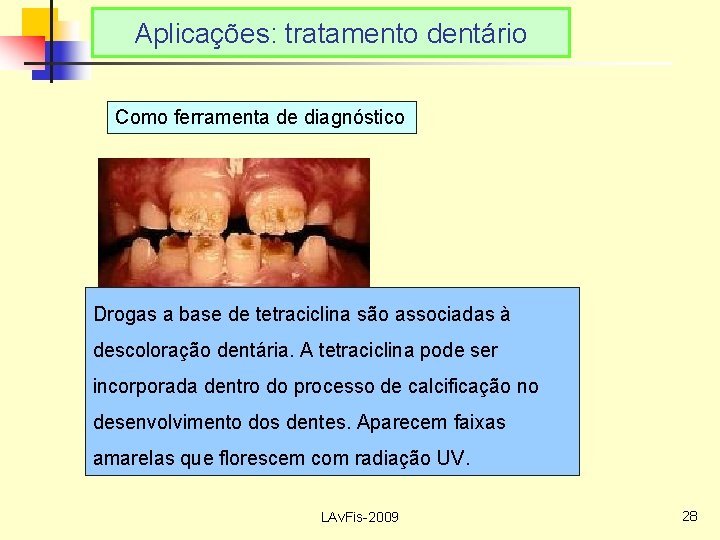 Aplicações: tratamento dentário Como ferramenta de diagnóstico Drogas a base de tetraciclina são associadas
