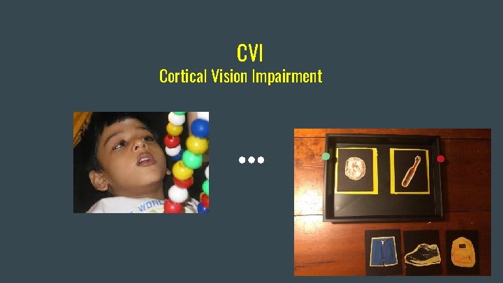 CVI Cortical Vision Impairment 