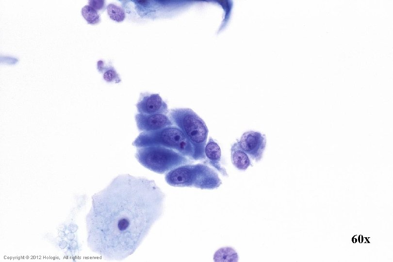 60 x Hologic Proprietary © 2012 Copyright © 2012 Hologic, All rights reserved 