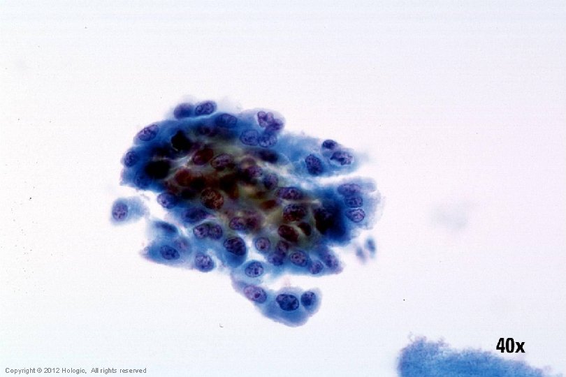 Hologic Proprietary © 2012 Copyright © 2012 Hologic, All rights reserved 