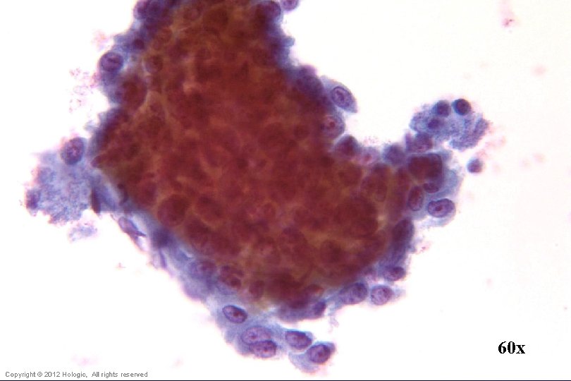 60 x Hologic Proprietary © 2012 Copyright © 2012 Hologic, All rights reserved 