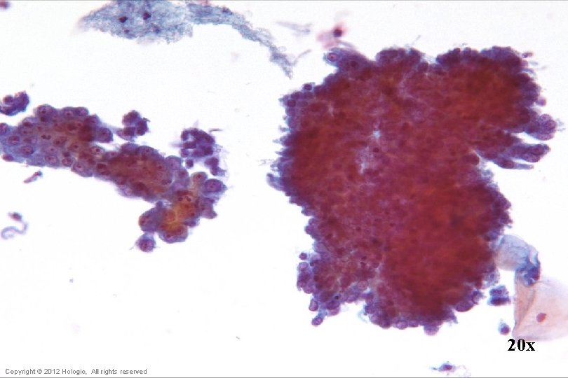 20 x Hologic Proprietary © 2012 Copyright © 2012 Hologic, All rights reserved 