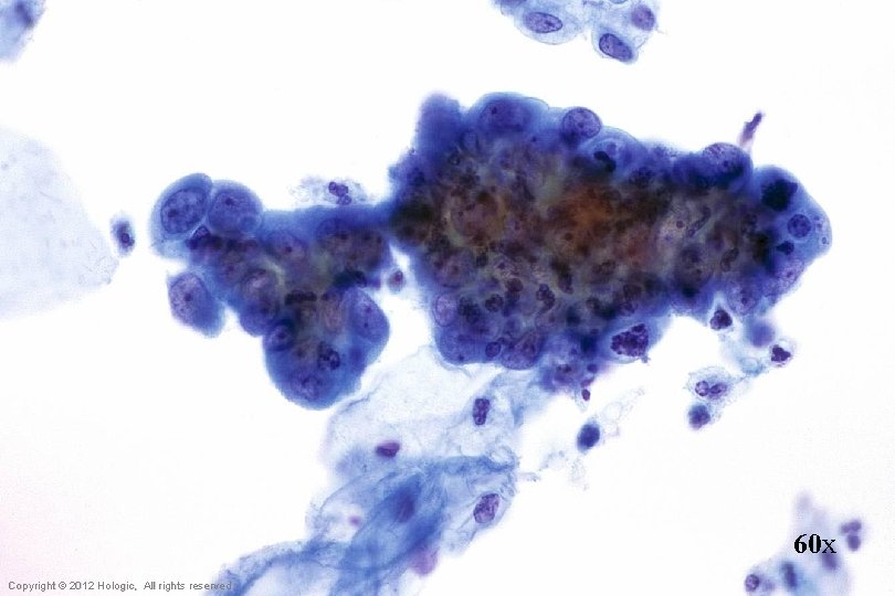 60 x Hologic Proprietary © 2012 Copyright © 2012 Hologic, All rights reserved 