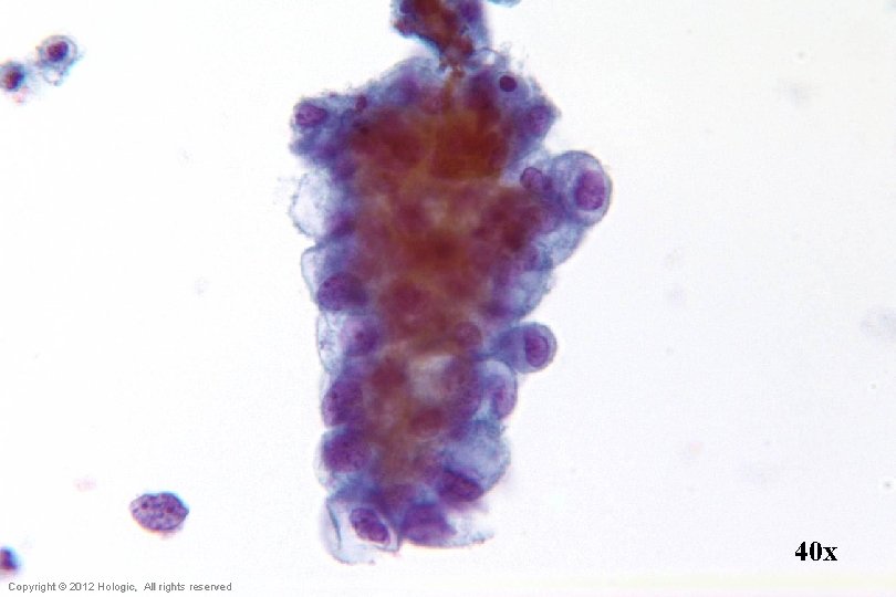 40 x Hologic Proprietary © 2012 Copyright © 2012 Hologic, All rights reserved 