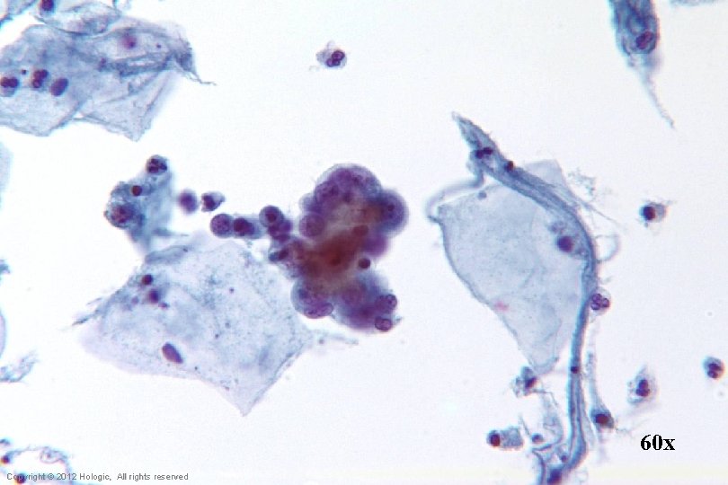 60 x Hologic Proprietary © 2012 Copyright © 2012 Hologic, All rights reserved 