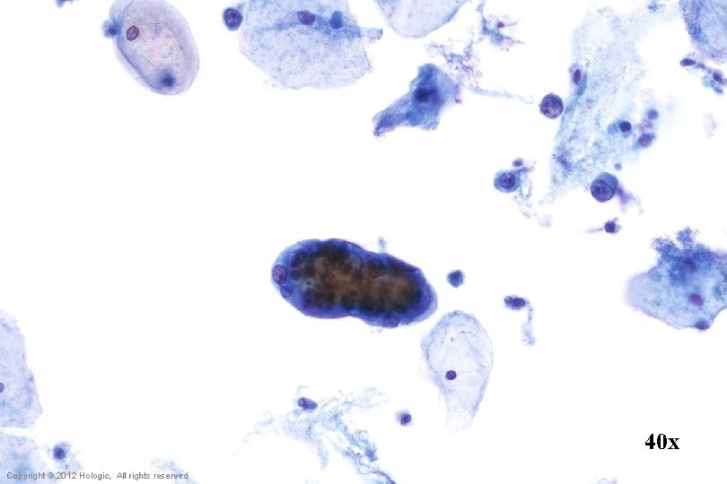 40 x Hologic Proprietary © 2012 Copyright © 2012 Hologic, All rights reserved 