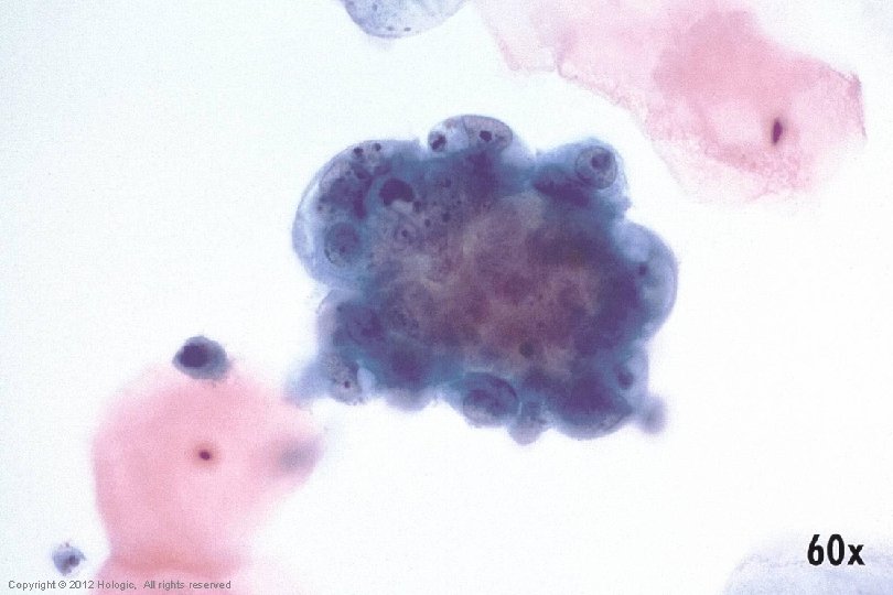 Hologic Proprietary © 2012 Copyright © 2012 Hologic, All rights reserved 