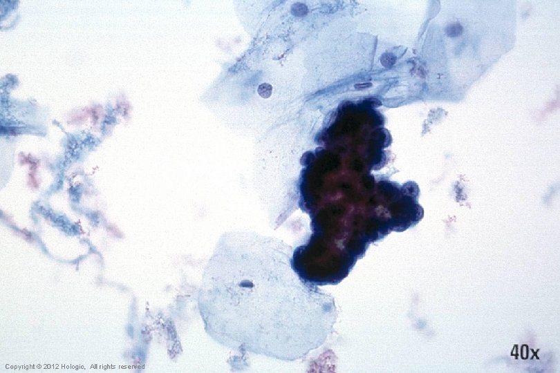 Hologic Proprietary © 2012 Copyright © 2012 Hologic, All rights reserved 