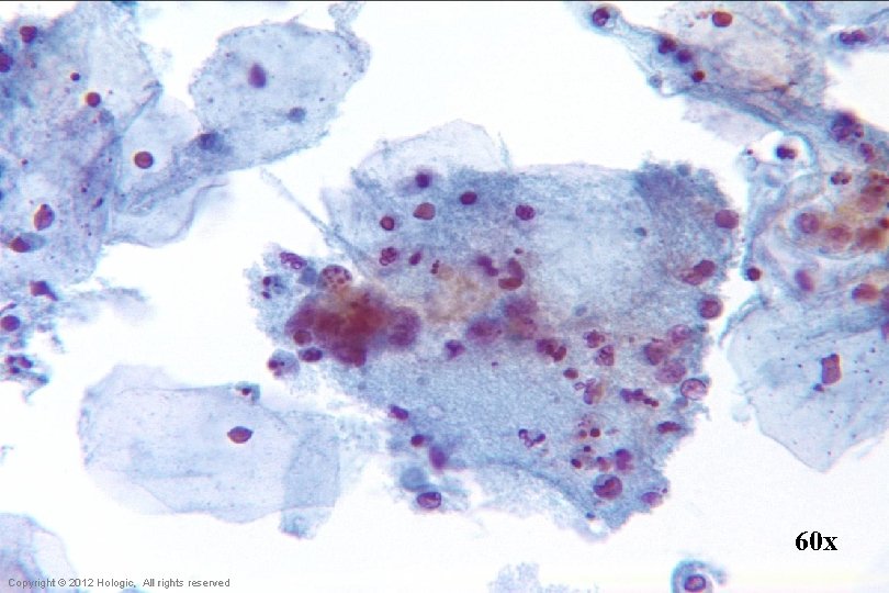 60 x Hologic Proprietary © 2012 Copyright © 2012 Hologic, All rights reserved 