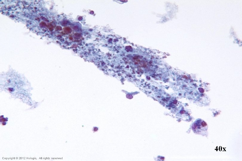 40 x Hologic Proprietary © 2012 Copyright © 2012 Hologic, All rights reserved 