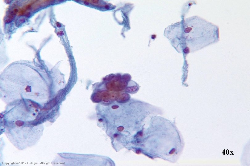 40 x Hologic Proprietary © 2012 Copyright © 2012 Hologic, All rights reserved 