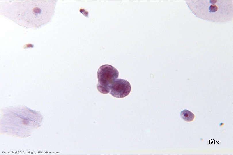 60 x Hologic Proprietary © 2012 Copyright © 2012 Hologic, All rights reserved 