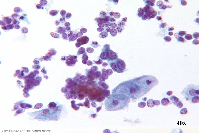 40 x Hologic Proprietary © 2012 Copyright © 2012 Hologic, All rights reserved 