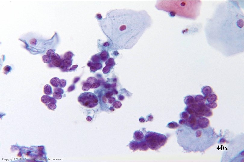 40 x Hologic Proprietary © 2012 Copyright © 2012 Hologic, All rights reserved 