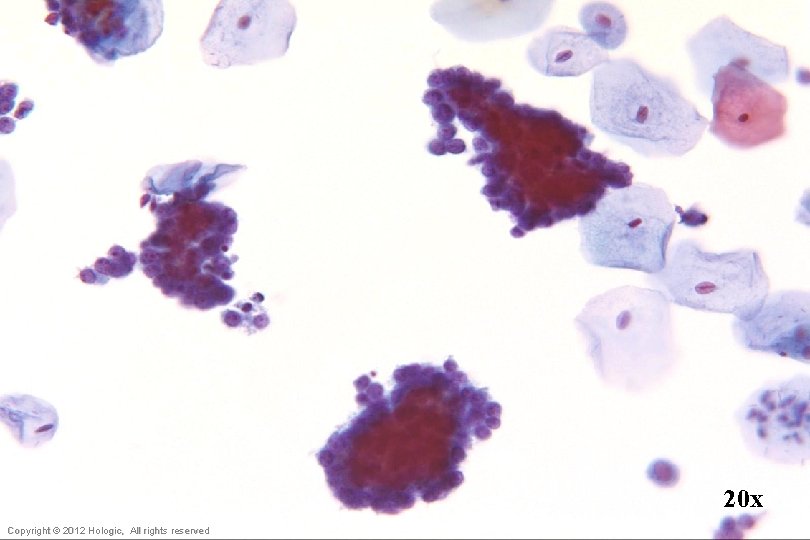 20 x Hologic Proprietary © 2012 Copyright © 2012 Hologic, All rights reserved 