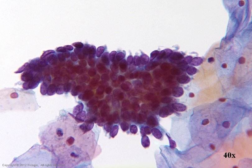 40 x Hologic Proprietary © 2012 Copyright © 2012 Hologic, All rights reserved 