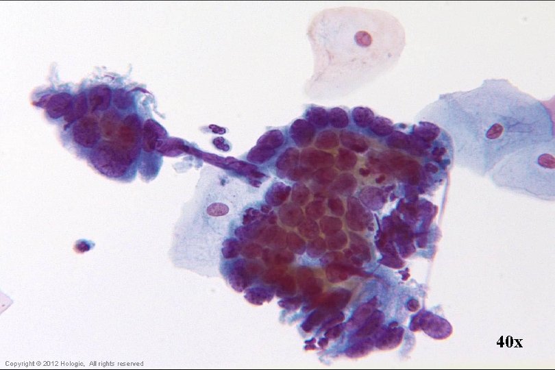 40 x Hologic Proprietary © 2012 Copyright © 2012 Hologic, All rights reserved 