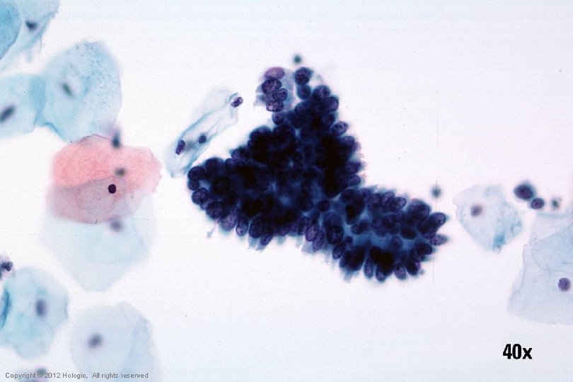 Hologic Proprietary © 2012 Copyright © 2012 Hologic, All rights reserved 