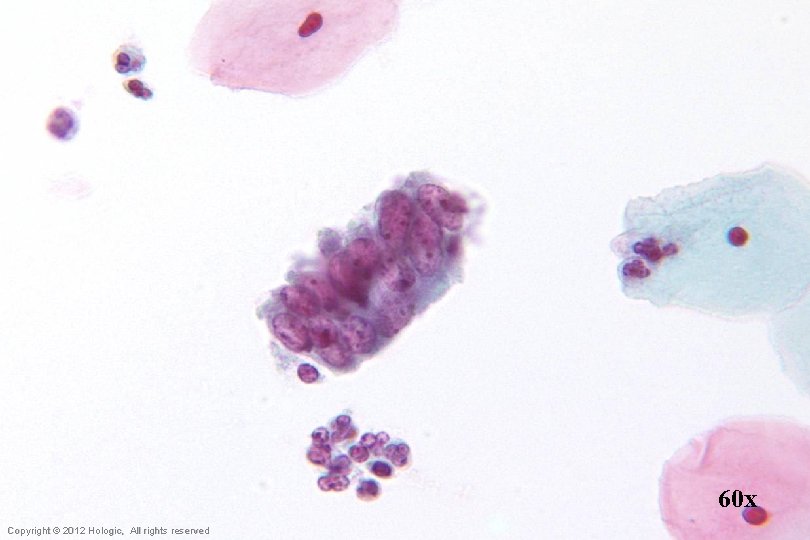 60 x Hologic Proprietary © 2012 Copyright © 2012 Hologic, All rights reserved 