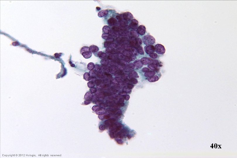 40 x Hologic Proprietary © 2012 Copyright © 2012 Hologic, All rights reserved 