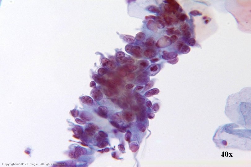 40 x Hologic Proprietary © 2012 Copyright © 2012 Hologic, All rights reserved 