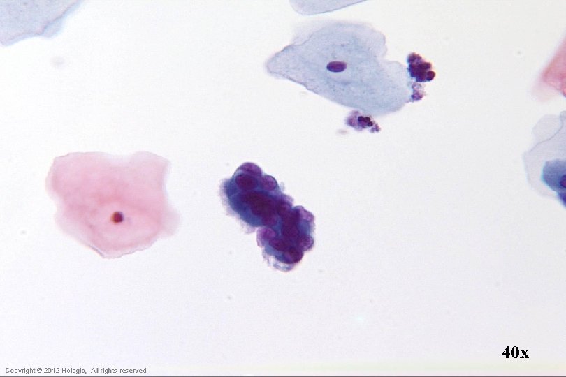 40 x Hologic Proprietary © 2012 Copyright © 2012 Hologic, All rights reserved 