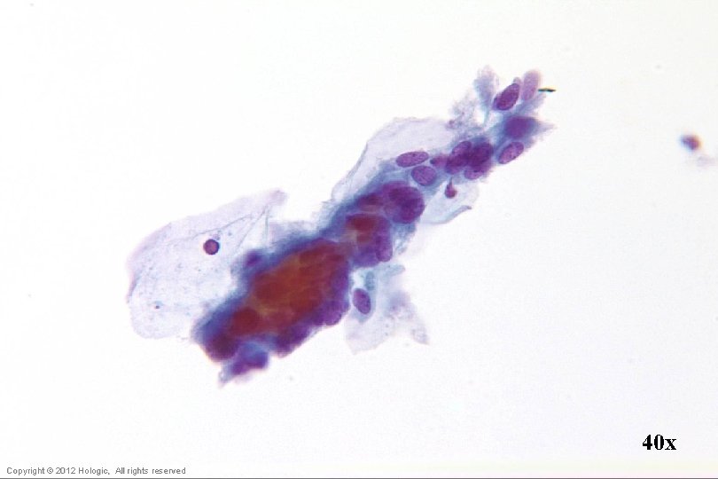 40 x Hologic Proprietary © 2012 Copyright © 2012 Hologic, All rights reserved 