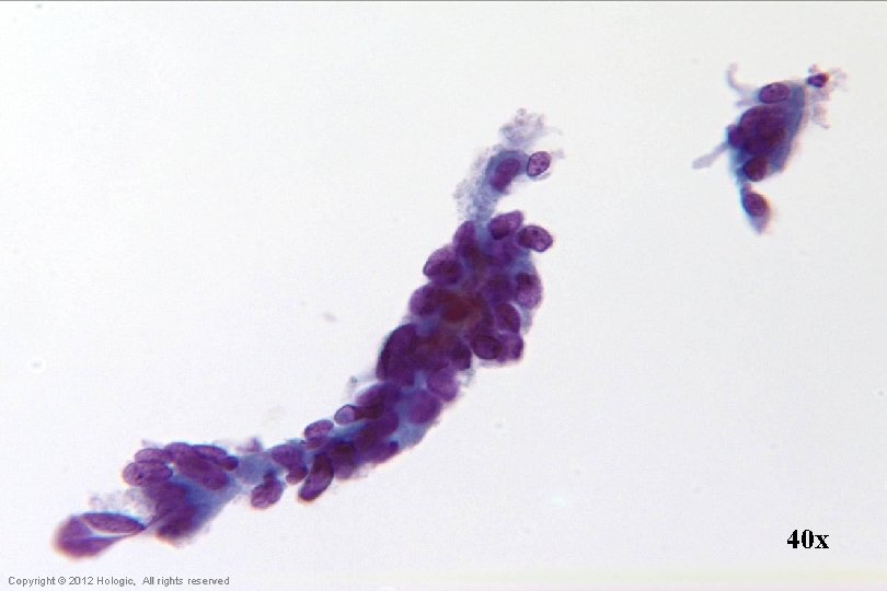 40 x Hologic Proprietary © 2012 Copyright © 2012 Hologic, All rights reserved 