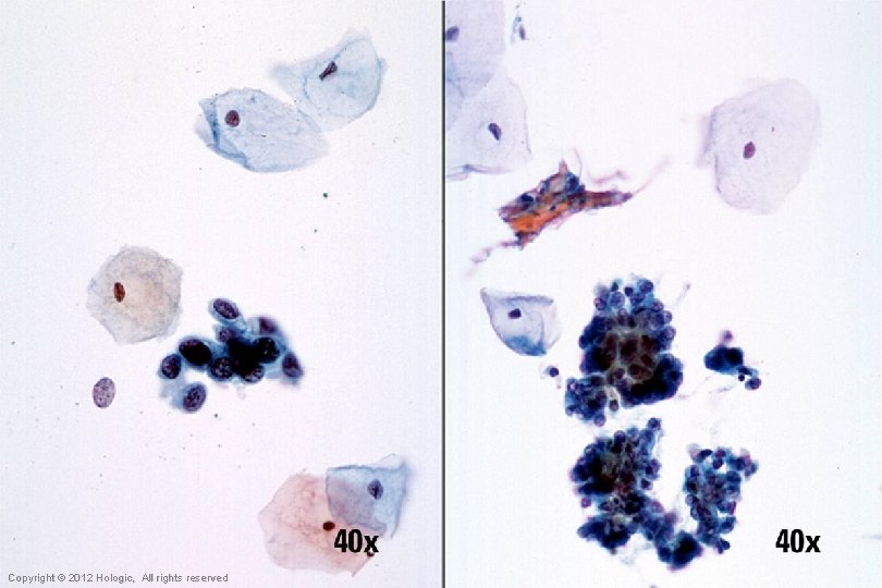 Hologic Proprietary © 2012 Copyright © 2012 Hologic, All rights reserved 