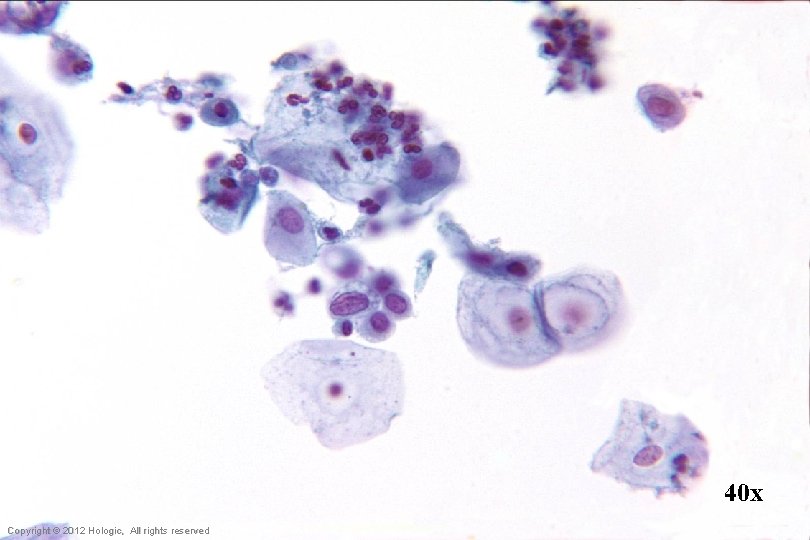 40 x Hologic Proprietary © 2012 Copyright © 2012 Hologic, All rights reserved 