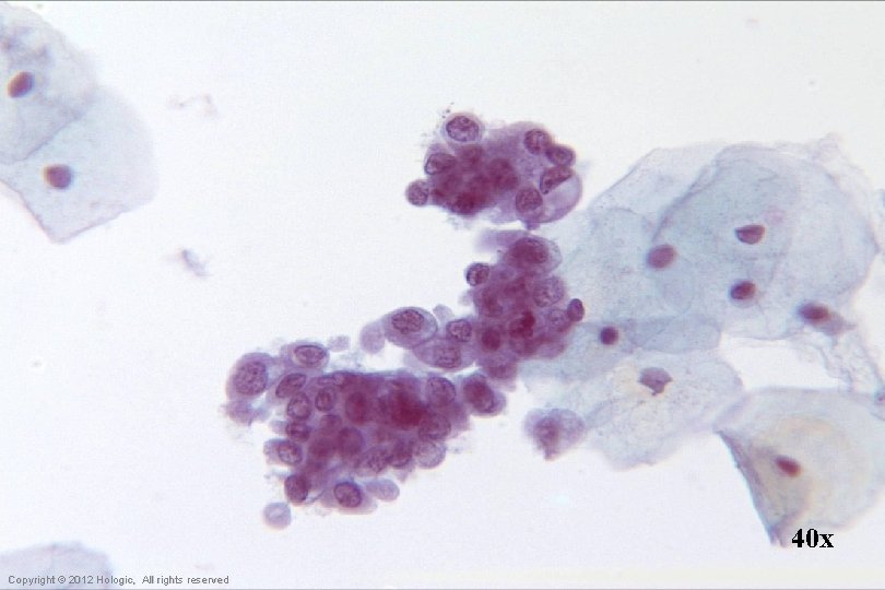 40 x Hologic Proprietary © 2012 Copyright © 2012 Hologic, All rights reserved 