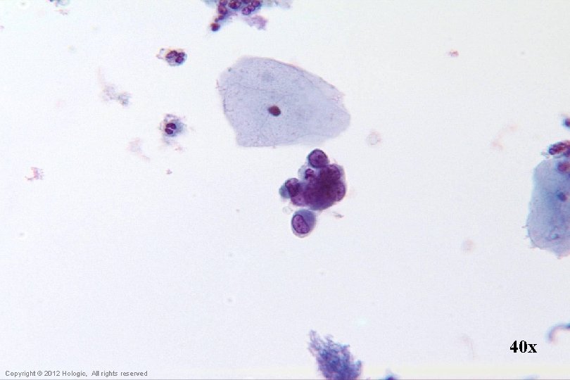 40 x Hologic Proprietary © 2012 Copyright © 2012 Hologic, All rights reserved 